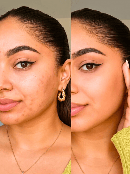 GlowSkin | Fond de Teint Boosté aux Sérums Botaniques